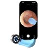 Na zdjęciu widoczny jest smartfon z wyświetlonym obrazem z otoskopu, przedstawiającym wnętrze ucha oraz niebieską końcówkę urządzenia. Na ekranie telefonu znajdują się napisy: "Clean Mode", "Acne-squeeze", a także ikony aparatu i wideo.