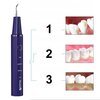 Skaler dentystyczny ORO-MED Oro-Scal Dent Niebieski Funkcje Ergonomiczny kształt
