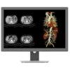 Na zdjęciu widoczny jest monitor wyświetlający cztery obrazy medyczne w odcieniach szarości po lewej stronie oraz kolorowy obraz anatomiczny po prawej stronie. Monitor to model "JUSHA CR240G 24" 1920x1200px IPS".