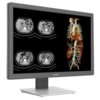 Monitor JUSHA CR240G 24" wyświetla obrazy medyczne, w tym cztery czarno-białe skany oraz jeden kolorowy obraz anatomiczny. Na ramce monitora widoczne jest logo "JUSHA".