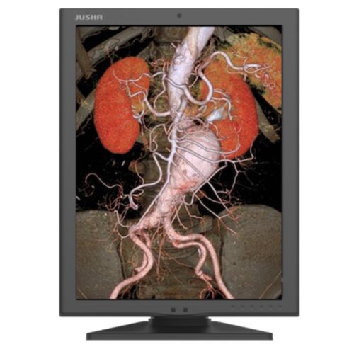 Monitor z wyświetlanym obrazem anatomicznym przedstawiającym układ krwionośny i nerki. Na ramce monitora widoczne jest logo "JUSHA".
