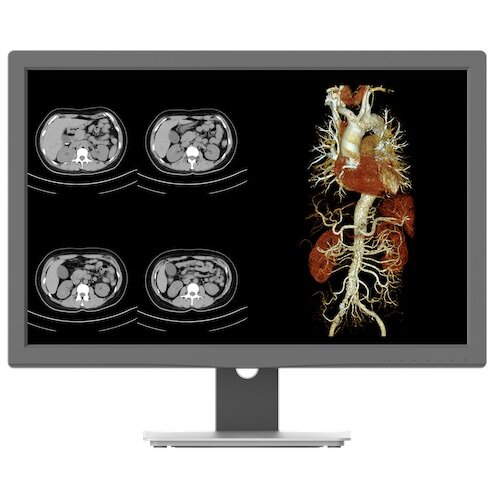 Na zdjęciu widoczny jest monitor wyświetlający cztery obrazy medyczne w odcieniach szarości po lewej stronie oraz kolorowy obraz anatomiczny po prawej stronie. Monitor to model "JUSHA CR240G 24" 1920x1200px IPS".
